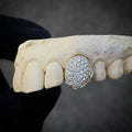 Hi Hopjewelry Custom Gold Plated 925 Sterling Silver Vvs Moissanite Diamond Iced Out Grilz Dental for Teeth Great Shopping 4You